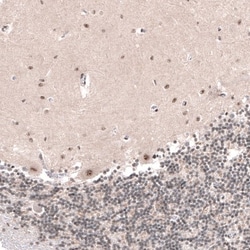 HYPB Antibody, Novus Biologicals 0.1mL; Unlabeled:Antibodies, Polyclonal